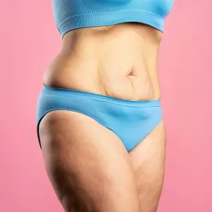 REDUCIR VOLÚMEN Colmenar Viejo